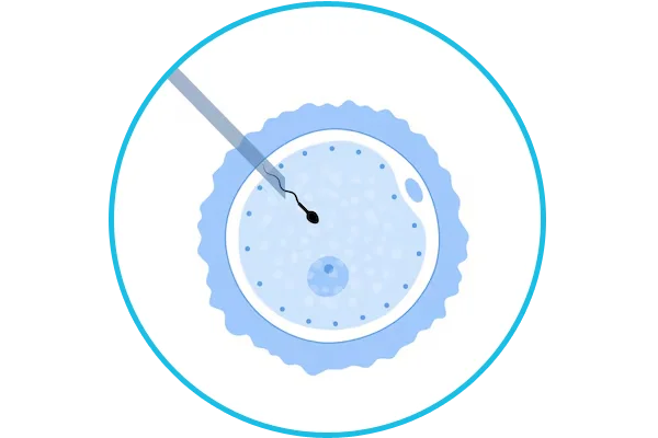 IVF