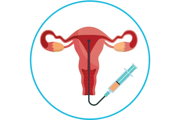 IUI
